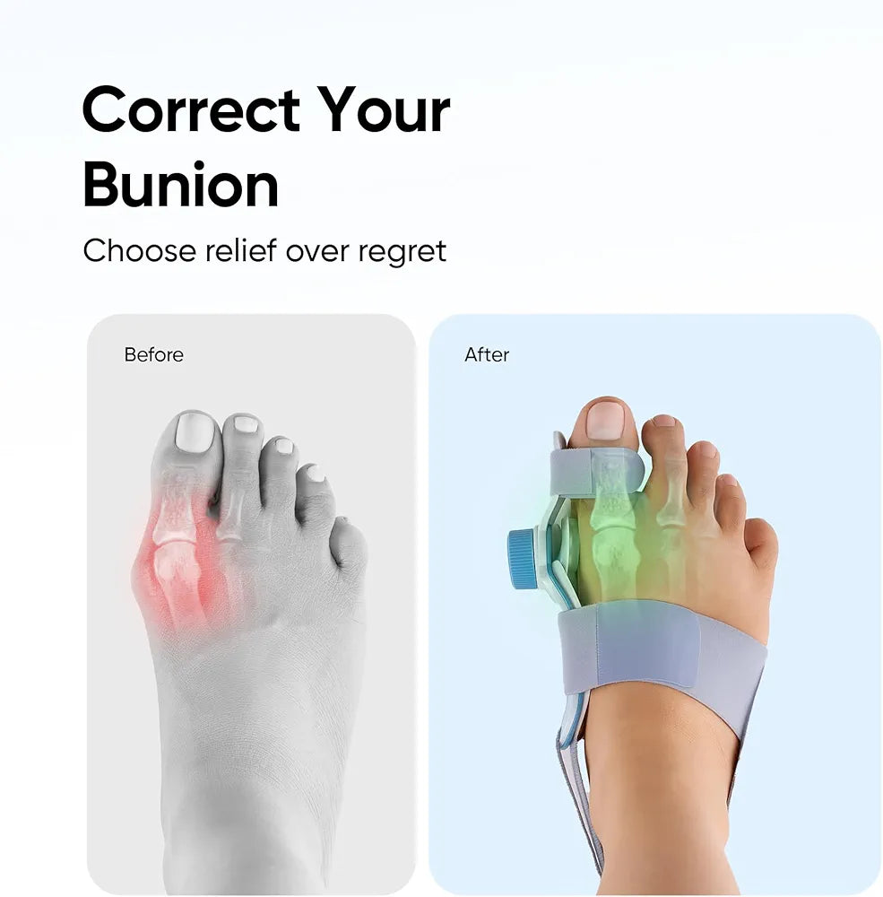 Orthopedic Bunion Splint for Men & Women
