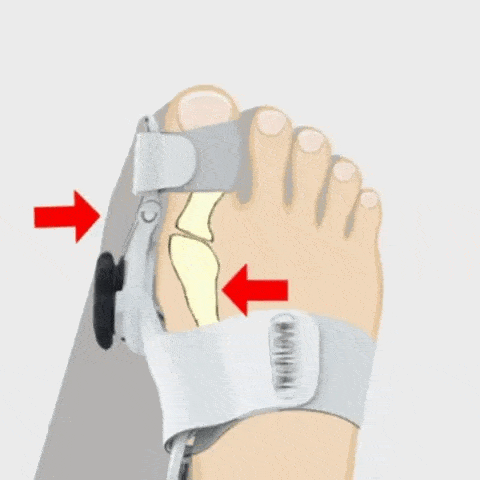Orthopedic Bunion Splint for Men & Women